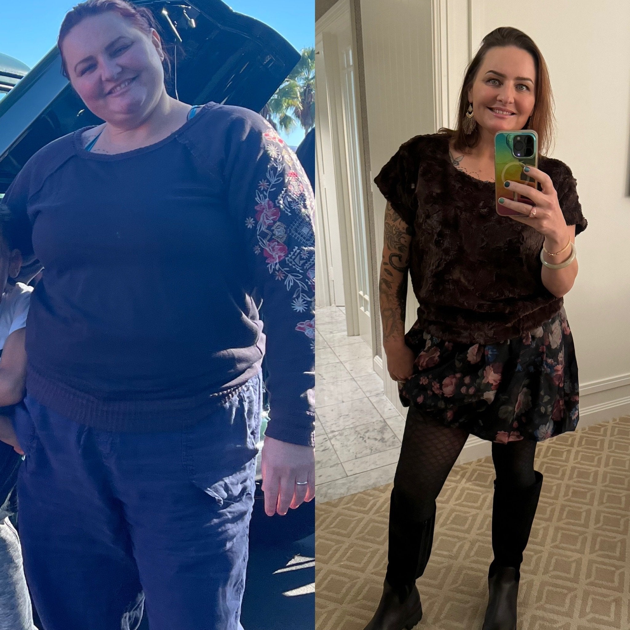 GLP-1s for Weight Loss: What are They and How Do They Work?