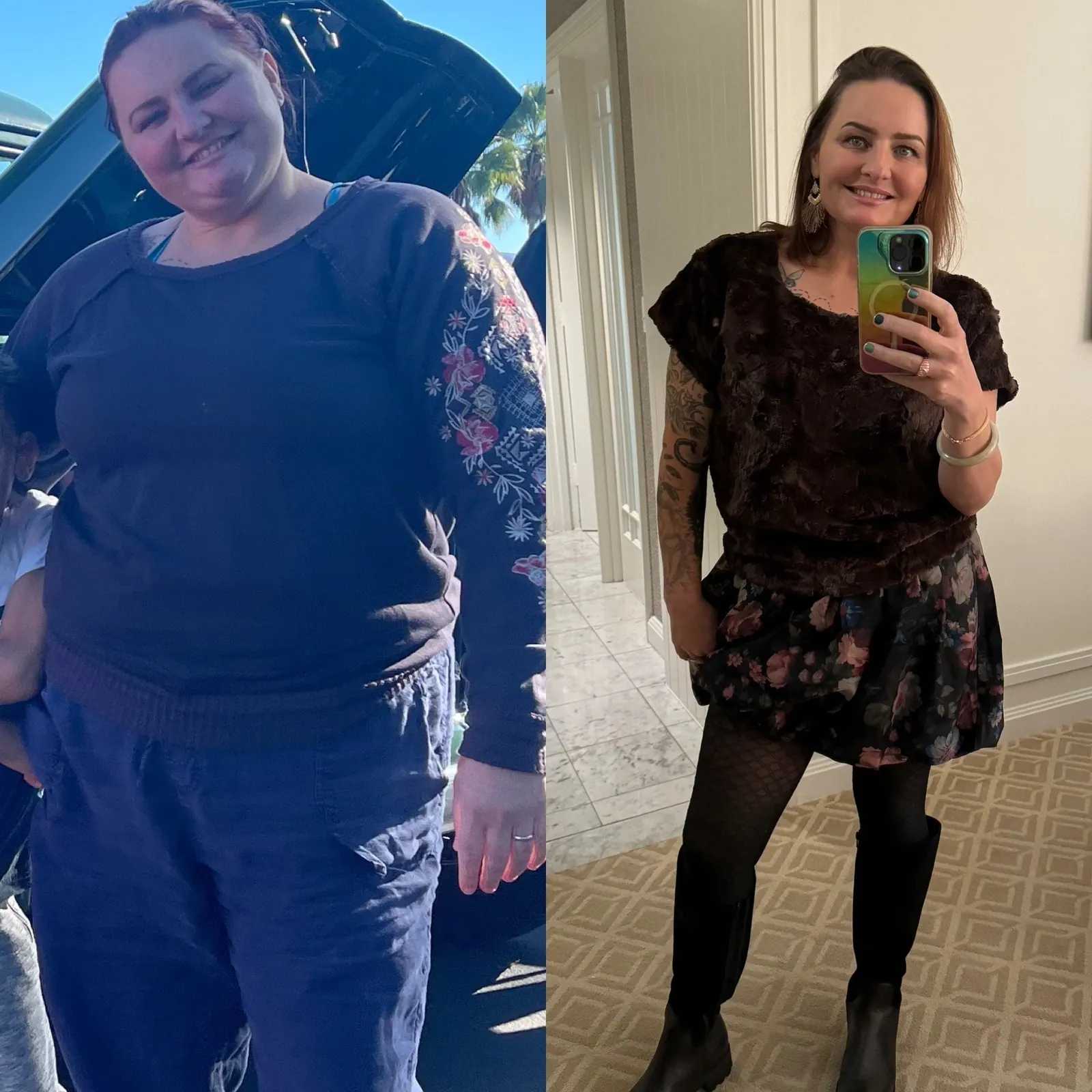 GLP-1s for Weight Loss: What are They and How Do They Work?