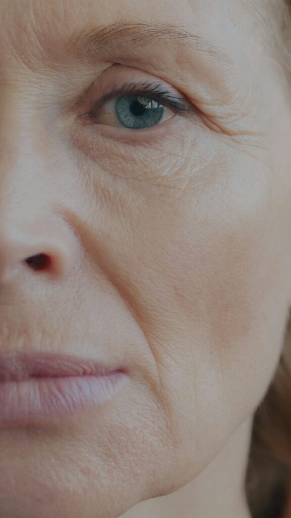 Close view of fine lines around the eye