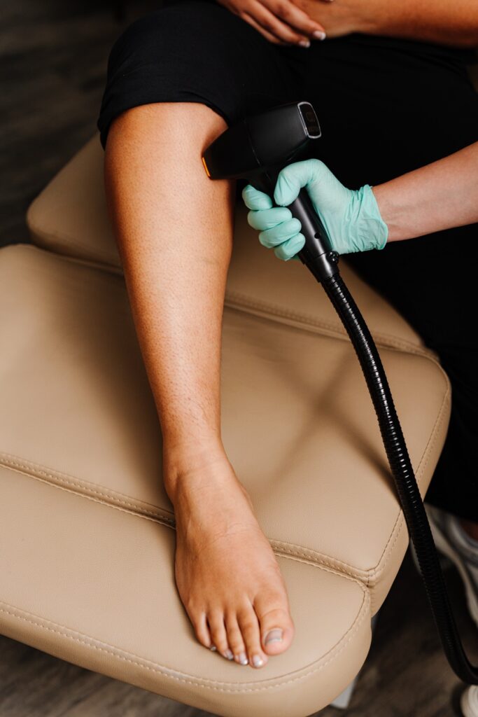 Laser hair removal on the lower leg