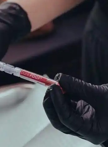 Gloved hands holding a syringe of pure PDGF