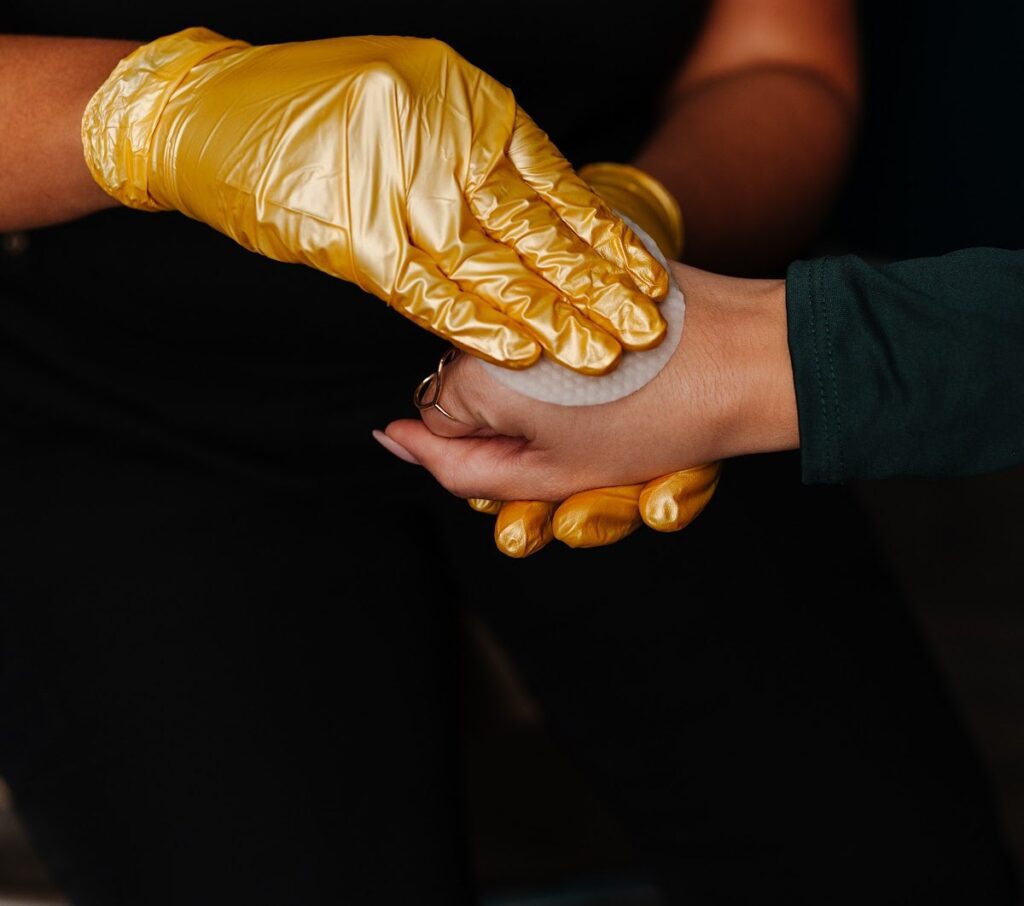 Gloved hand applying a treatment pad to a patient's hand