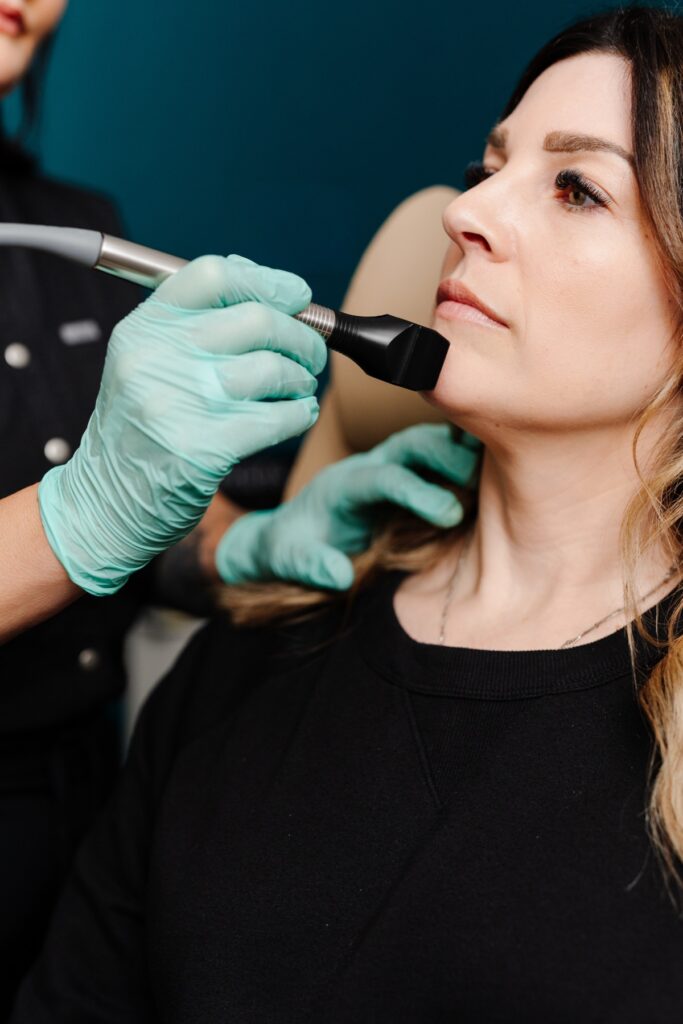 RF microneedling handpiece along the jawline